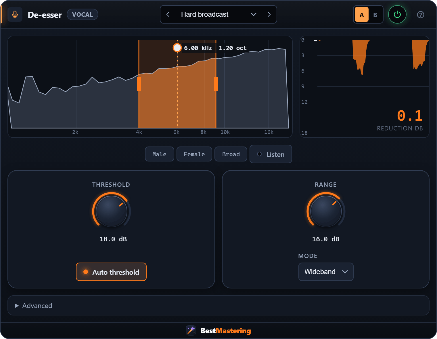 De-esser plugin interface